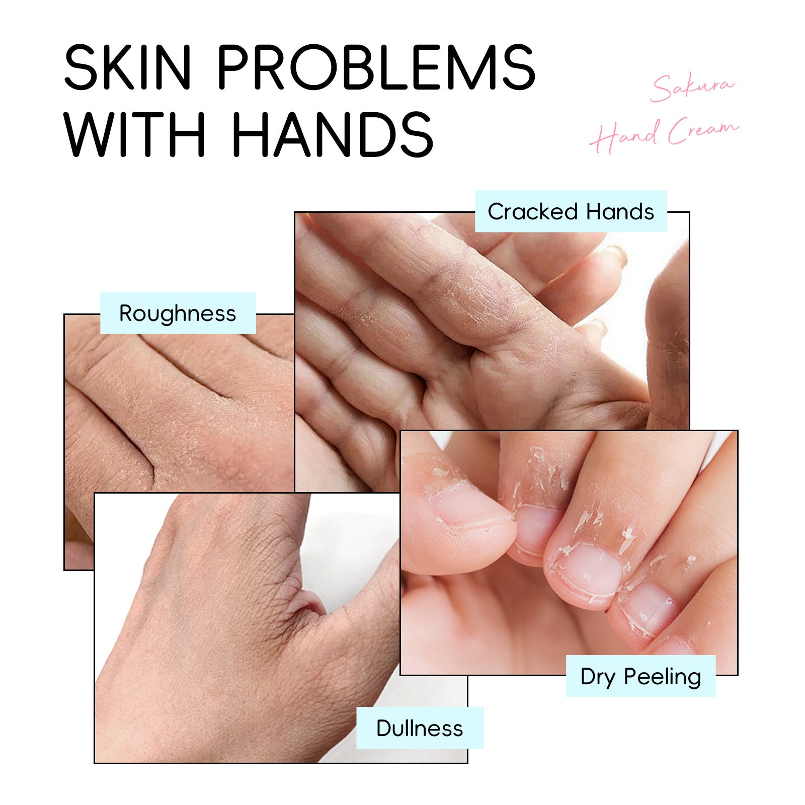 Crema de Manos Hidratante de Cereza de Laikou 30g: Frescura y Hidratación, Producto Aprobado por