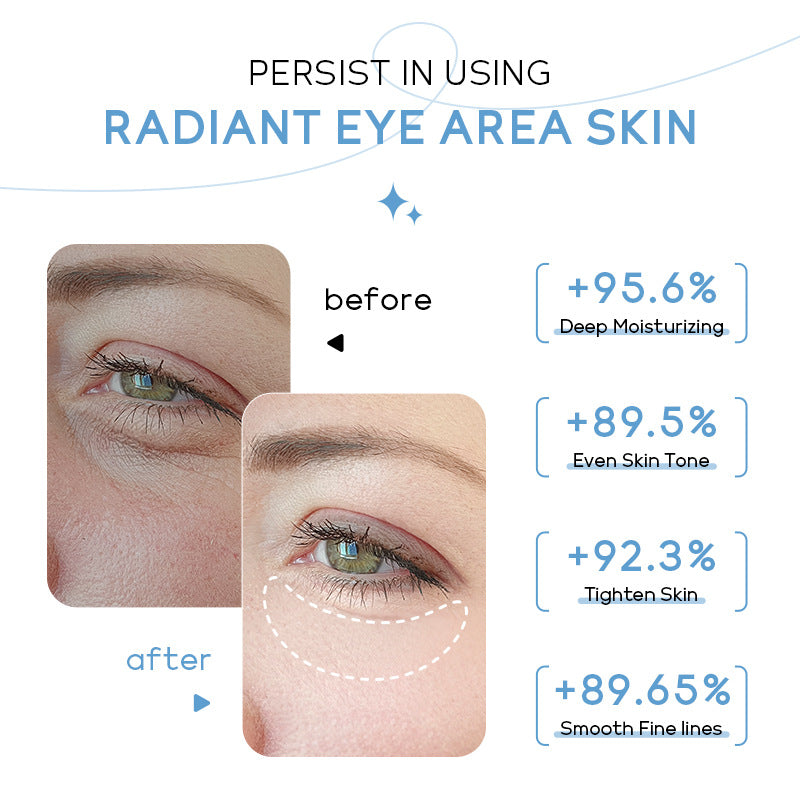 LAIKOU Crema de Ojos con Leche: Hidratación y Luminosidad para el Contorno de Ojos - 20g